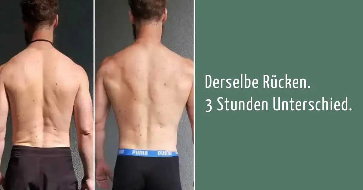 Biomechanik Check - günstige Spannungsverhältnisee für schmerzfreies Bewegen